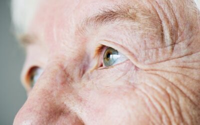 Szürke hályog: kialakulása, típusai, tünetei, és megelőzése